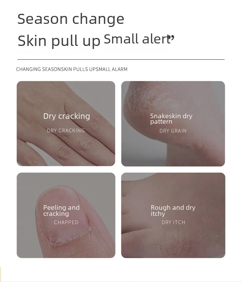 Crème Hydratante Pour Les Mains Et Les Pieds Laurel Vaseline Huile Cheval Anti-Rides Pour L'Hiver Nourrissante Et Moisturisante display picture 4